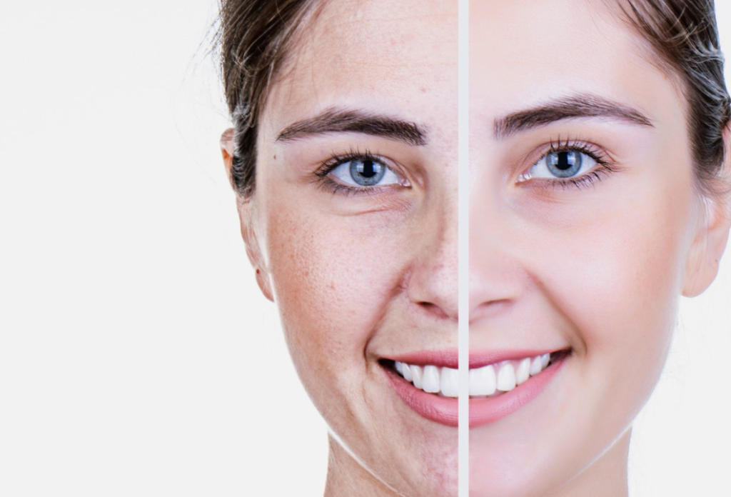 Anti-Aging Benefits -glutathione injections